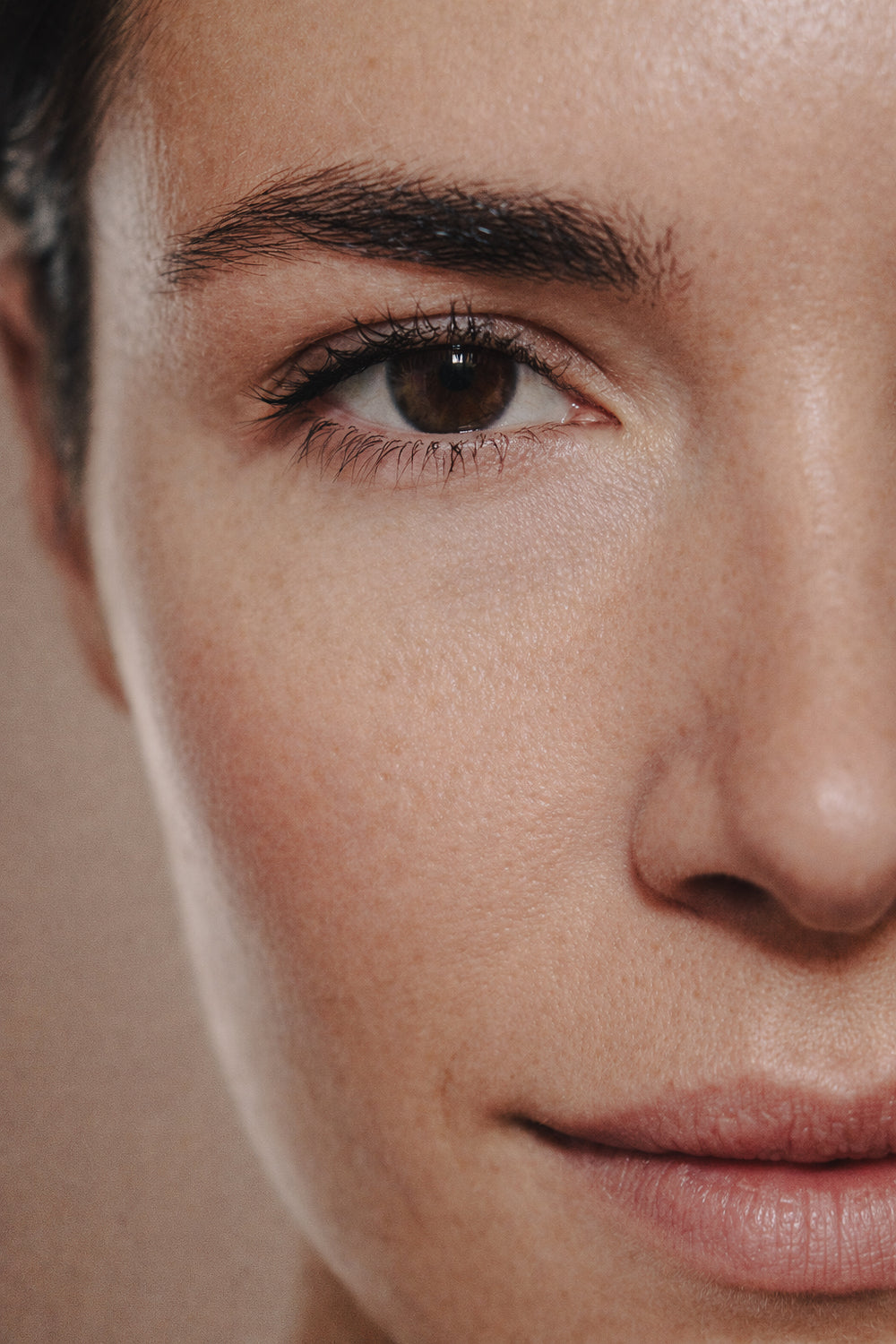 What Are Enlarged Pores?