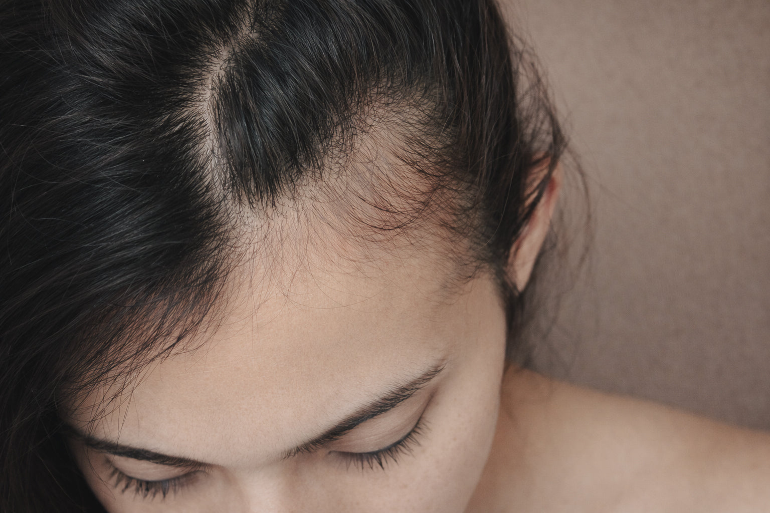 Hair Loss Treatment