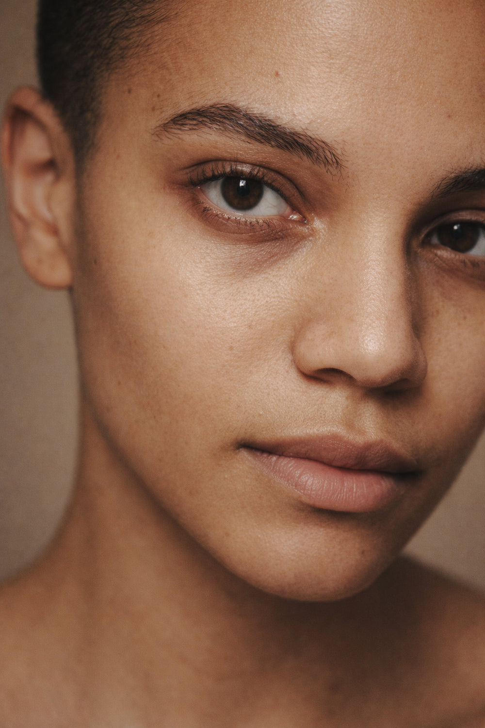 What Causes Dark Circles and Eye Bags?