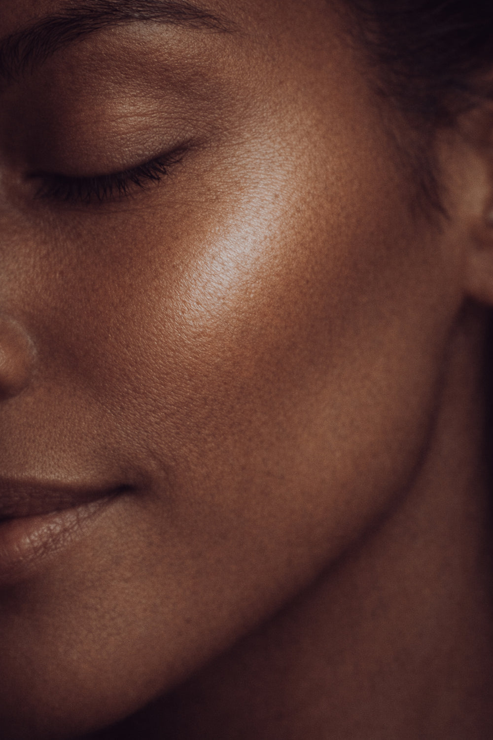 Why Choose Dermal Fillers?