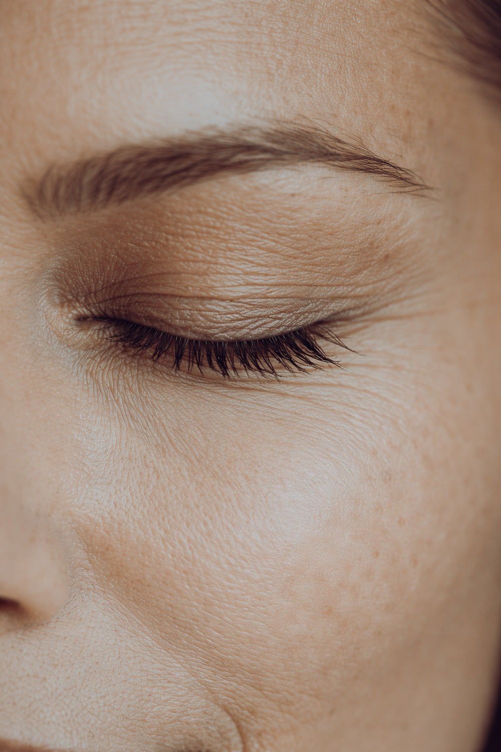 What Causes Dull Skin?