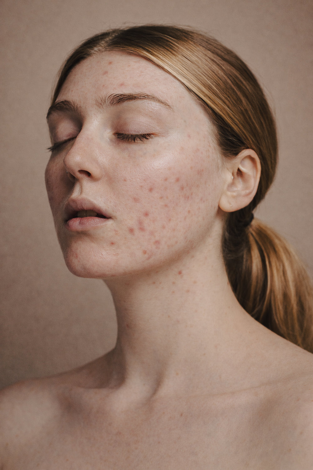 Broad-Spectrum Light Therapy