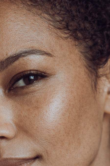 Pigmentation & Redness