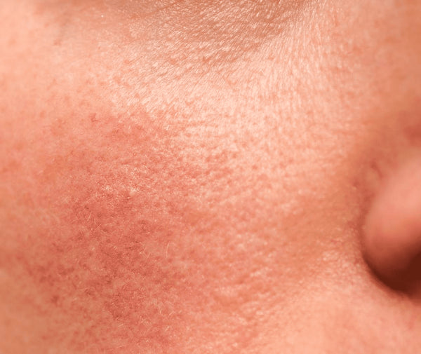 Phyto Corrective Essence Mist